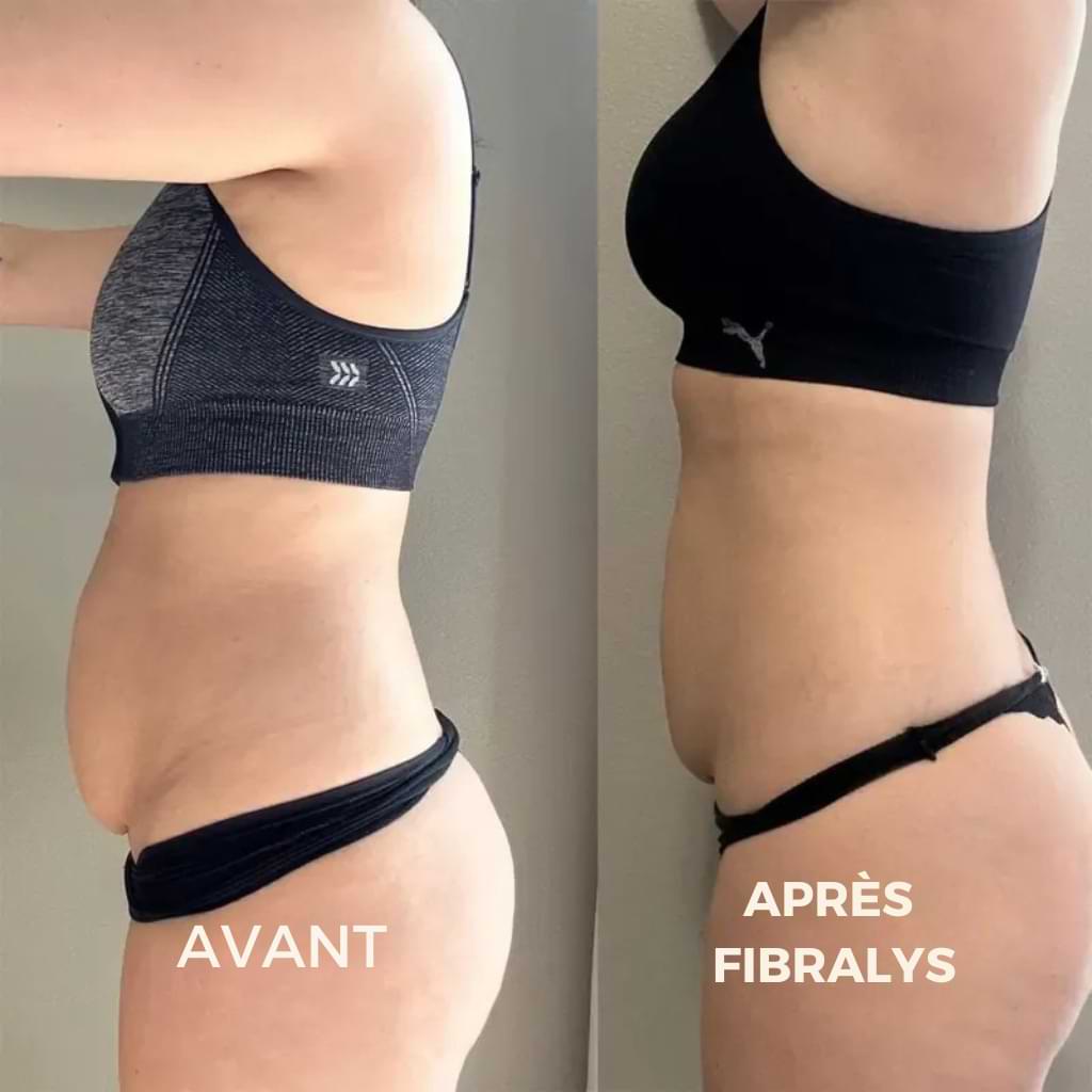 Fibralys Triple Action