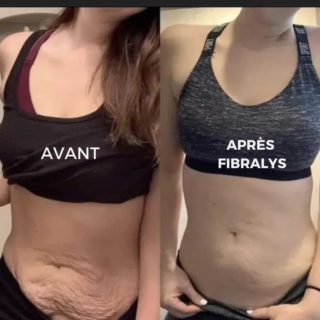 Fibralys Triple Action
