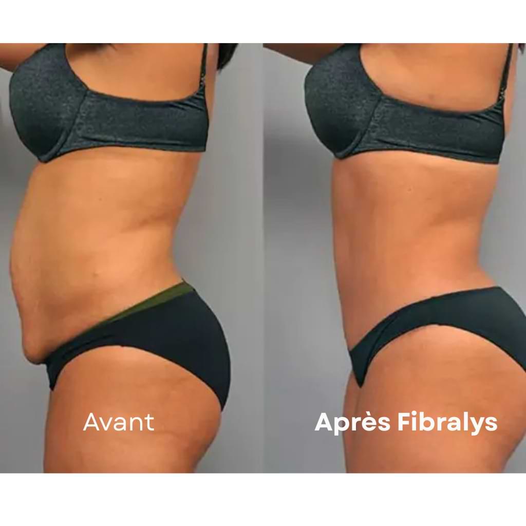 Fibralys Triple Action