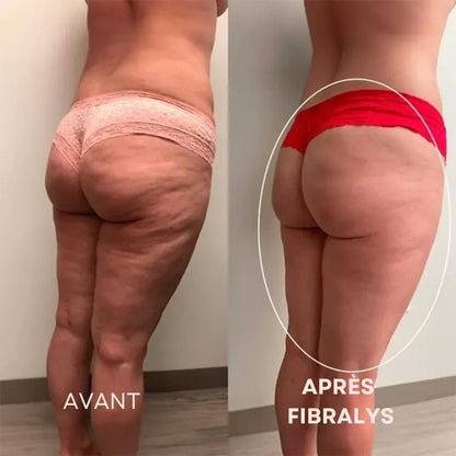 Fibralys Triple Action